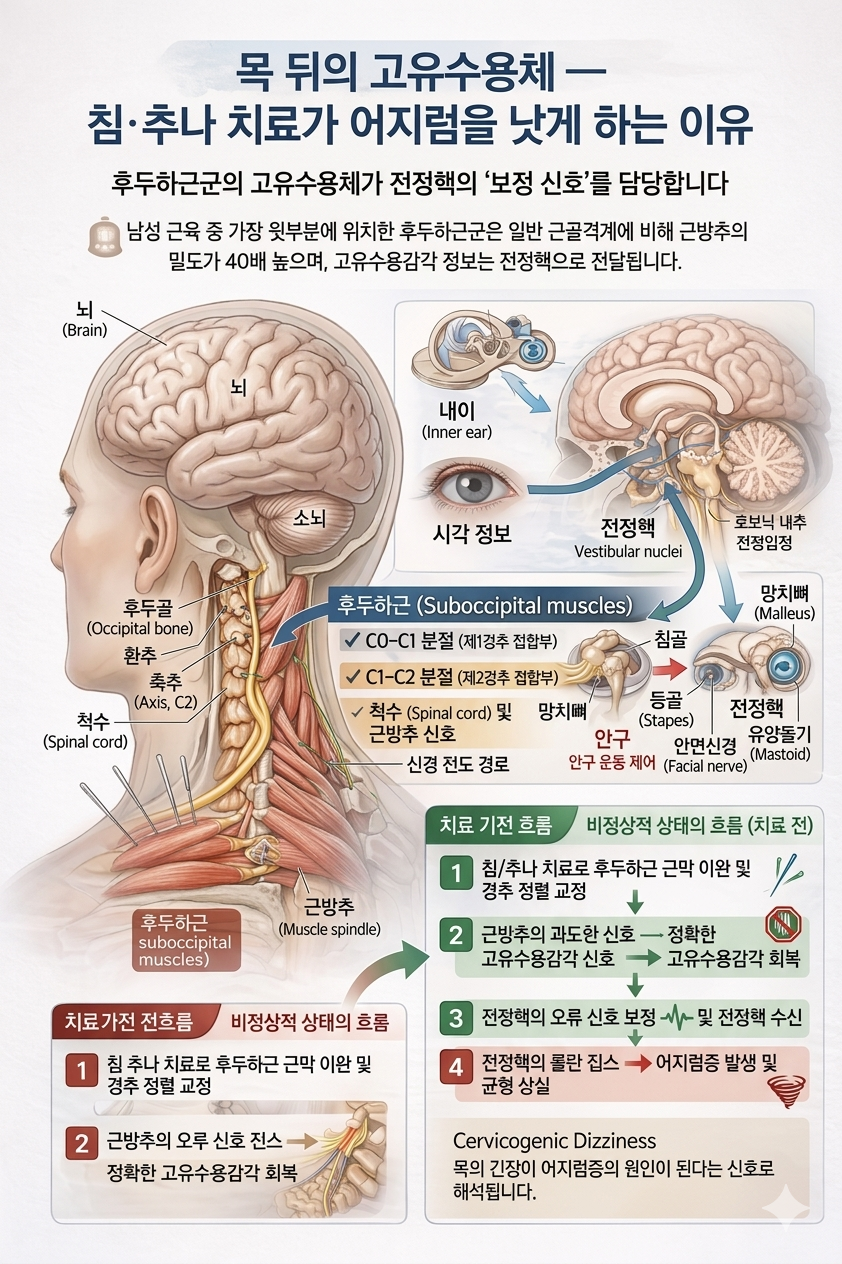 어지럼증 침치료 기전