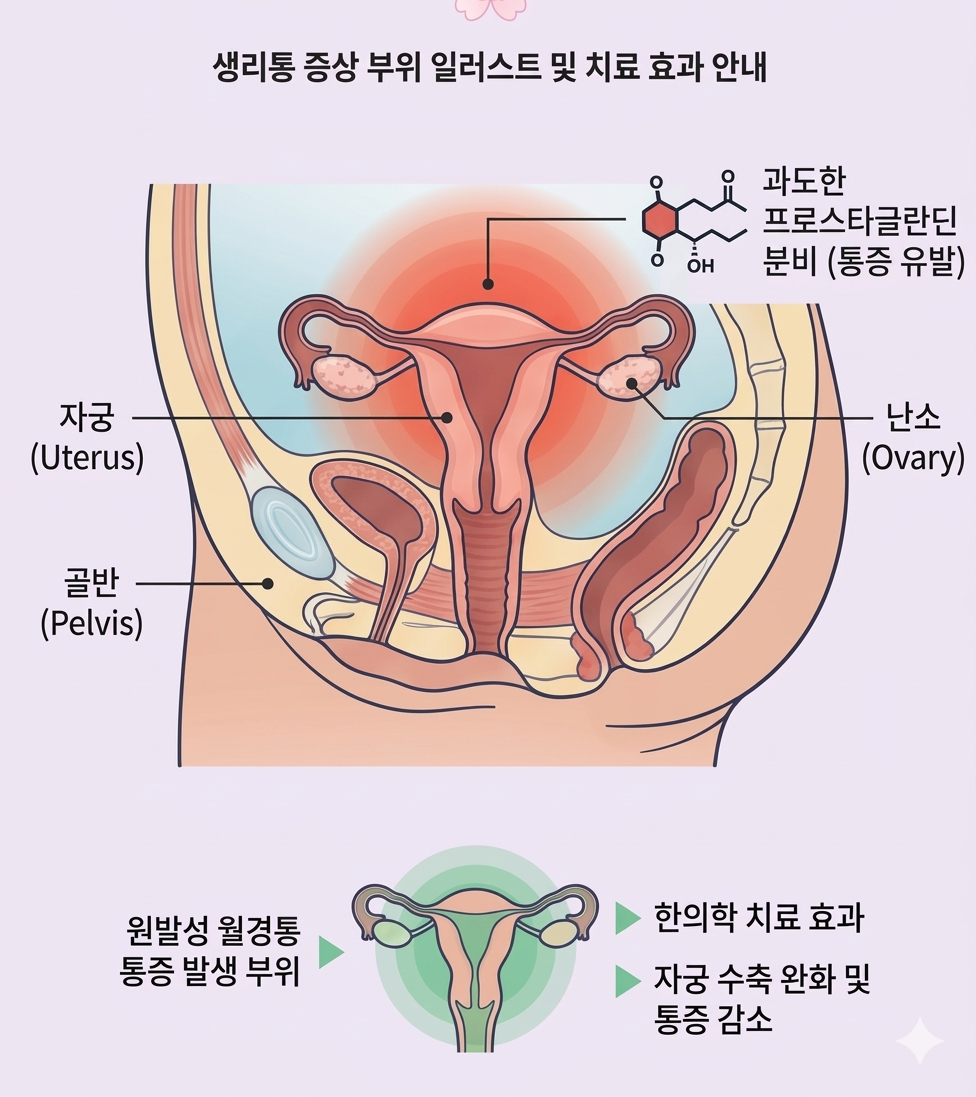 월경통의 분류